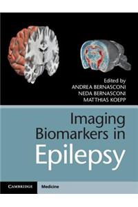 Imaging Biomarkers in Epilepsy