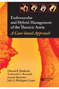 Endovascular and Hybrid Management of the Thoracic Aorta