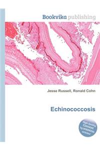 Echinococcosis