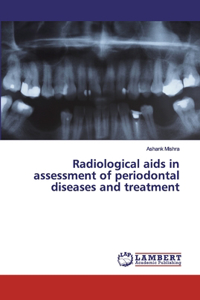 Radiological aids in assessment of periodontal diseases and treatment