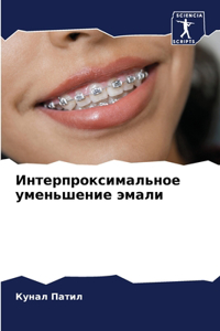 Интерпроксимальное уменьшение эмали