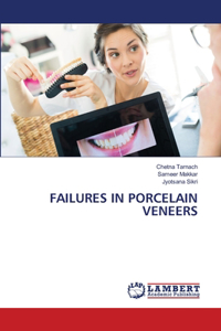 Failures in Porcelain Veneers