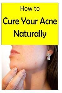 How to Cure Your Acne Naturally