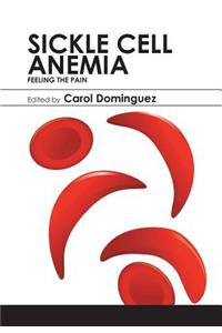 Sickle Cell Anemia