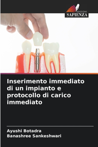 Inserimento immediato di un impianto e protocollo di carico immediato