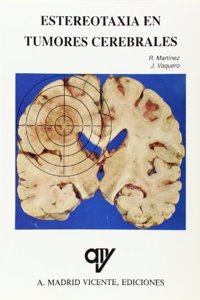 Estereotaxia en tumores cerebrales