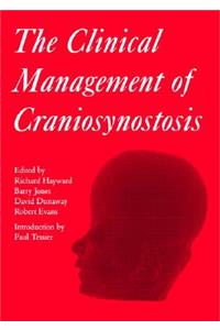 Clinical Management of Craniosynostosis