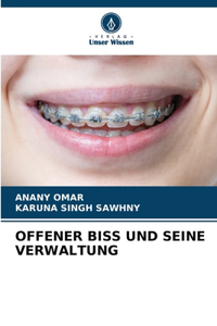 Offener Biss Und Seine Verwaltung