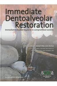 Immediate Dentoalveolar Restoration: Immediately Loaded Implants in Compromised Sockets