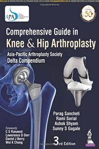 Comprehensive Guide in Knee & Hip Arthroplasty