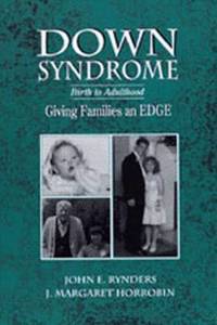 Down Syndrome: Birth to Adulthood
