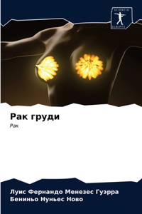 Рак груди