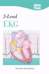 3-Lead EKG: Ventricular Dysrhythmias (CD)