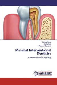 Minimal Interventional Dentistry