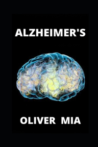 Alzheimer's