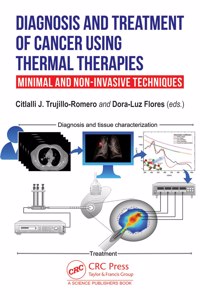 Diagnosis and Treatment of Cancer using Thermal Therapies