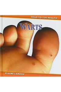 Warts