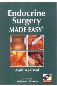 Endocrine Surgery Made Easy