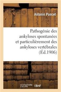 Pathogénie Des Ankyloses Spontanées Et Particulièrement Des Ankyloses Vertébrales