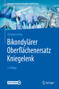 Bikondylärer Oberflächenersatz Kniegelenk