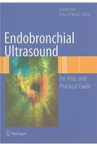 Endobronchial Ultrasound