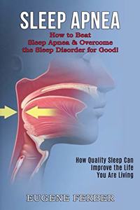 Sleep Apnea