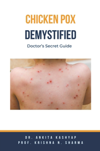 Chickenpox Demystified