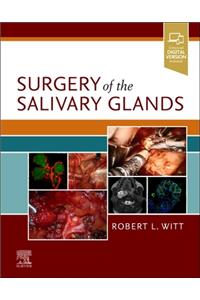 Surgery of the Salivary Glands