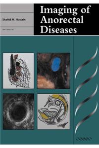 Imaging of Anorectal Diseases
