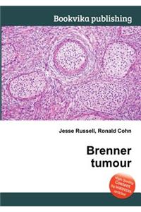 Brenner Tumour