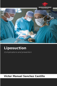 Liposuction