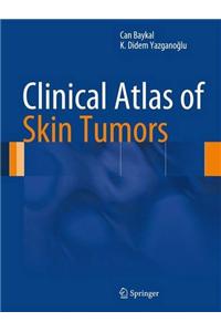 Clinical Atlas of Skin Tumors