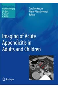 Imaging of Acute Appendicitis in Adults and Children