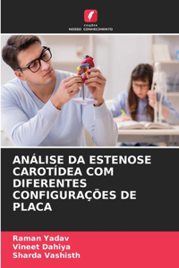 Análise Da Estenose Carotídea Com Diferentes Configurações de Placa
