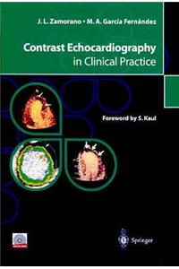Contrast Echocardiography in Clinical Practice
