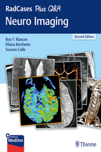 Radcases Plus Q&A Neuro Imaging