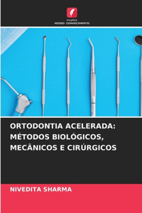 Ortodontia Acelerada: Métodos Biológicos, Mecânicos E Cirúrgicos