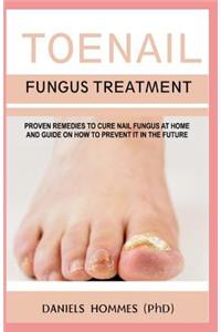 Toenail Fungus Treatment