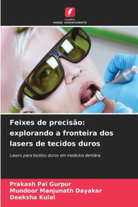 Feixes de precisão
