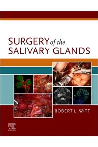 Surgery of the Salivary Glands E-Book