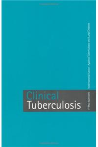 Clinical Tuberculosis