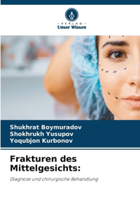 Frakturen des Mittelgesichts