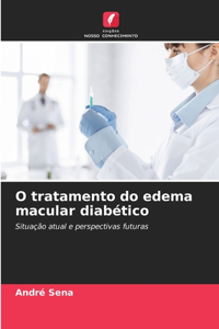 O tratamento do edema macular diabético