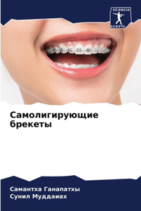 Самолигирующие брекеты