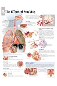 Effects of Smoking Laminated Poster