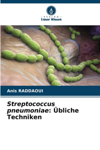 Streptococcus pneumoniae