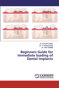 Beginners Guide for Immediate loading of Dental Implants