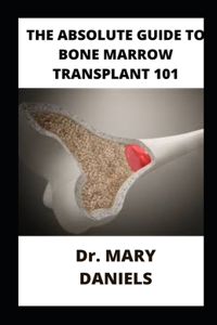 Absolute Guide To Bone Marrow Transplant 101