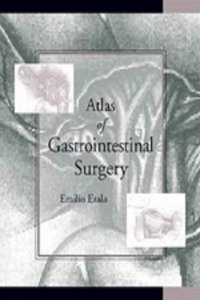 Atlas of Gastrointestinal Surgery: 002