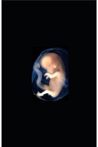 Surrogate